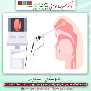 آندوسکوپی سینوس | دکتر علیرضا مومنی