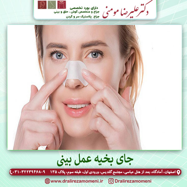 جای بخیه عمل بینی - دکتر علیرضا مومنی