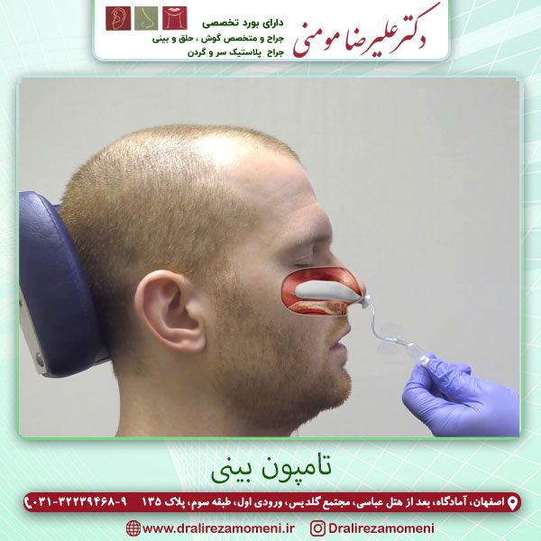 عکس برداشتن تامون بینی - دکتر علیرضا مومنی