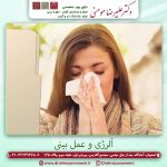 آلرژی و عمل بینی | درمان آلرژی با جراحی بینی امکانپذیر است؟