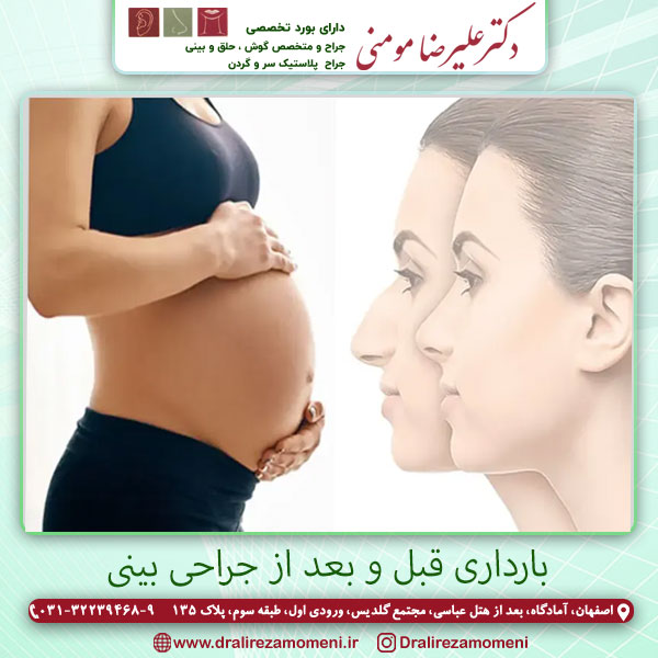 رایطه بارداری و جراحی بینی - دکتر علیرضا مومنی اصفهان