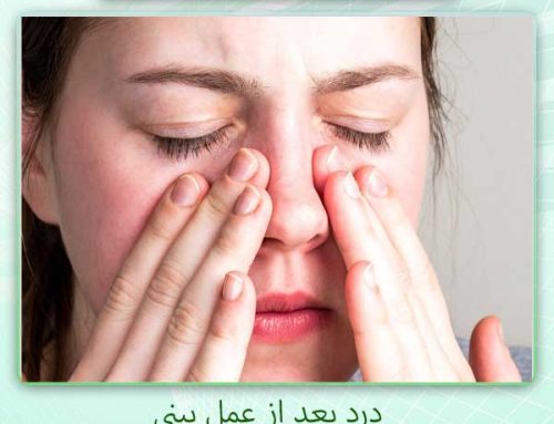 درد بینی بعد از عمل