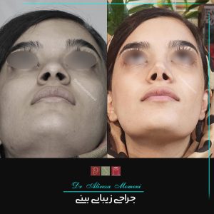 نمونه کار دکتر بینی بانوان