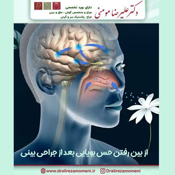 از بین رفتن حس بویایی بعد از جراحی بینی