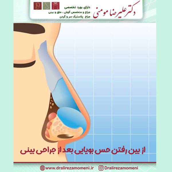 از بین رفتن حس بویایی بعد از جراحی بینی
