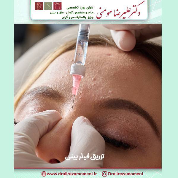 تزریق فیلر بینی