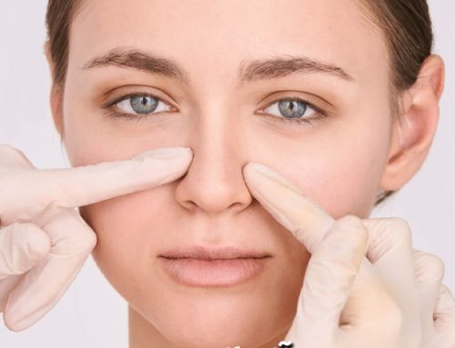 آلارپلاستی چیست؟
