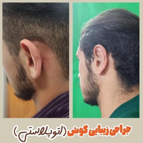 جراحی-گوش-18