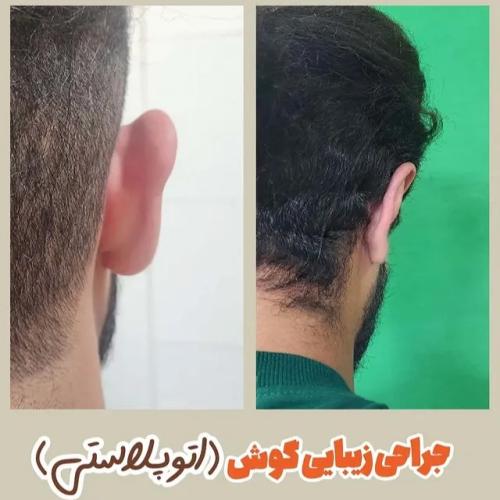 جراحی-گوش-19
