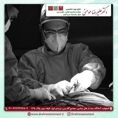 جراحی-بینی-40