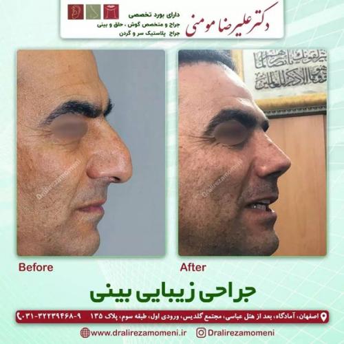 جراحی-بینی-400