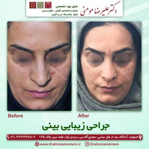 جراحی-بینی341